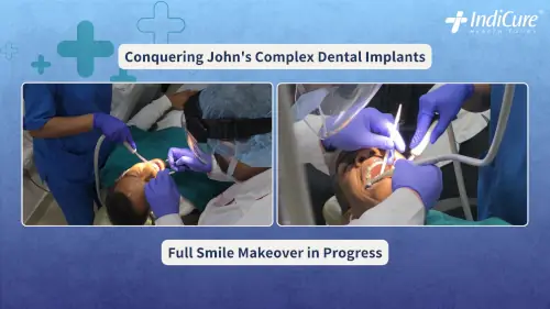 Close-up of John receiving advanced dental treatment in India, specifically complex dental implants necessary for his Full Smile Makeover. Image highlights the quality of his Dental Work in India.